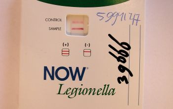 Legionella pneumophila  culture 