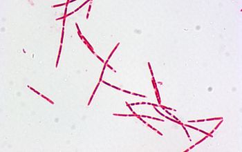 Leptotrichia buccalis Gram stain