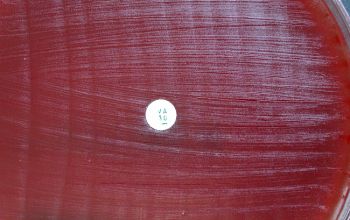 Leuconostoc lactis Blood Agar 24h culture incubated with CO2