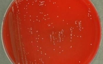 Leuconostoc lactis Blood Agar 48h culture incubated with CO2
