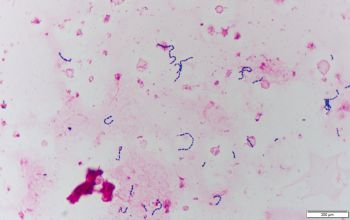 Leuconostoc mesenteroides Gram stain