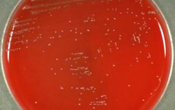 Leuconostoc mesenteroides Blood Agar 48h culture incubated with CO2