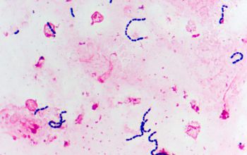 Leuconostoc mesenteroides Gram stain