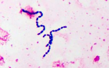 Leuconostoc mesenteroides Gram stain