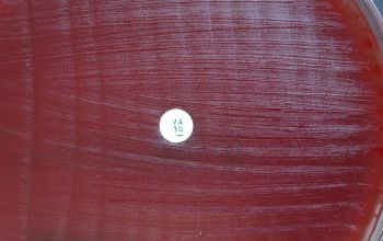 Leuconostoc mesenteroides Brucella Blood Agar 24h culture incubated with CO2