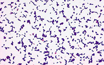 Listeria monocytogenes Gram stain
