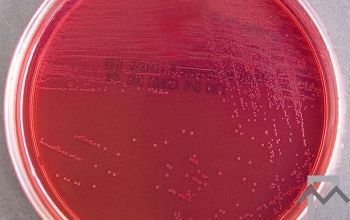 Listeria monocytogenes Mac Conkey Agar without salt 24h culture incubated with CO2