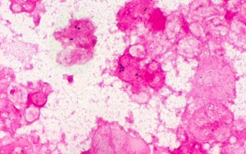 Listeria monocytogenes Gram stain