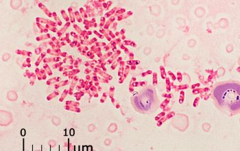 Methylobacterium species Gram stain