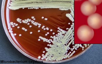 Microbacterium oxydans Blood Agar 48h culture incubated with O2