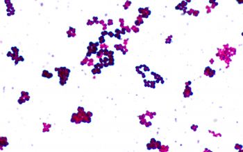 Micrococcus luteus Gram stain