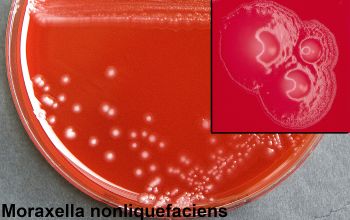 Moraxella nonliquefaciens Blood Agar 48h culture incubated with O2
