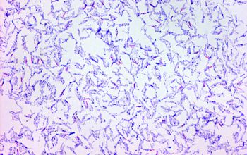 Mycobacterium chelonae Gram stain