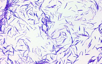 mycobacterium gram stain