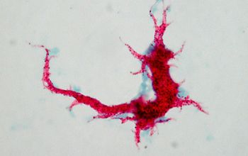 Mycobacterium tuberculosis Ziehl Niessen stain