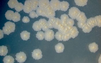 Mycobacterium tuberculosis  culture 