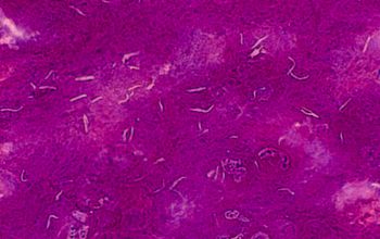 mycobacterium gram stain