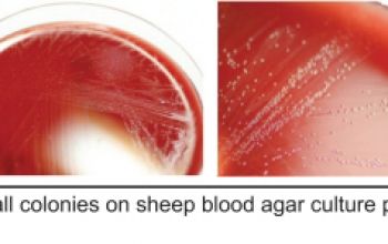 Mycoplasma hominis Blood Agar 48h culture 