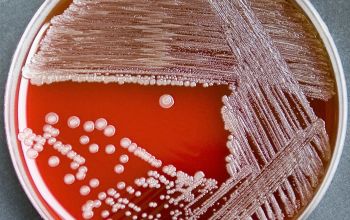 Neisseria canis Blood Agar 48h culture incubated with CO2