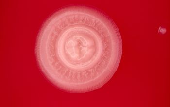 Neisseria canis Blood Agar 48h culture incubated with CO2