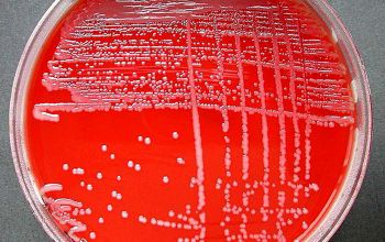 Neisseria meningitidis Blood Agar 24h culture incubated with CO2