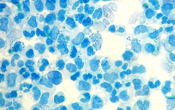 Neisseria meningitidis Methylene blue stain