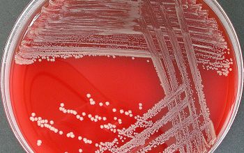 Neisseria subflava Blood Agar 24h culture incubated with CO2
