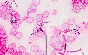 Nocardia astroides Gram stain
