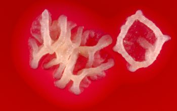 Nocardia otitidiscaviarum Blood Agar 48h culture incubated with CO2