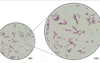 Ochrobactrum anthropi (Brucella anthropi) 