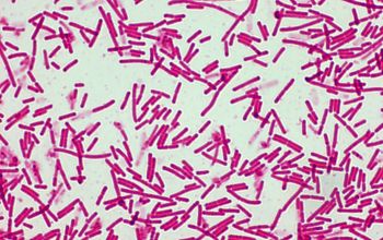 Paenibacillus amylolyticus Gram stain