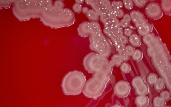 Paenibacillus amylolyticus Blood Agar 48h culture incubated with O2