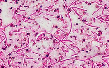 Paenibacillus amylolyticus Wirtz stain
