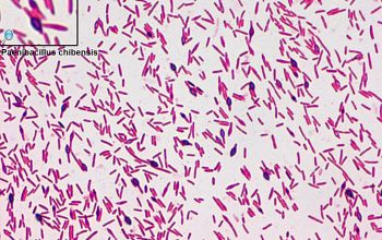 Paenibacillus chibensis Gram stain