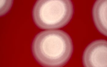 Paenibacillus chibensis Blood Agar 48h culture incubated with O2