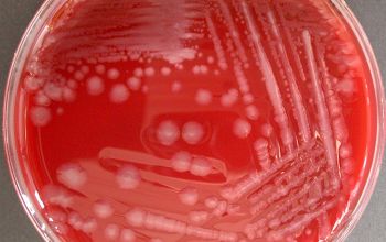 Paenibacillus macerans Blood Agar 48h culture incubated with CO2
