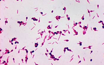 Paenibacillus macerans Gram stain