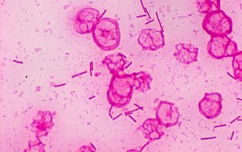 Paenibacillus macerans Gram stain
