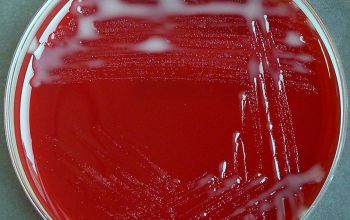 Paracoccus yeei Blood Agar 24h culture incubated with CO2