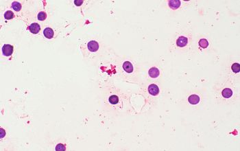 Paracoccus yeei Gram stain