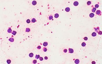 Paracoccus yeei Gram stain