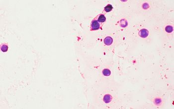 Paracoccus yeei Gram stain