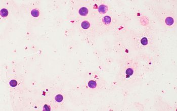 Paracoccus yeei Gram stain