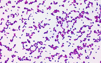 Peptostreptococcus anaerobius Gram stain