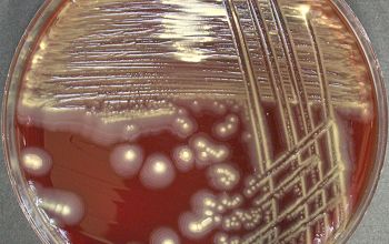 Proteus vulgaris Blood Agar 48h culture incubated with O2
