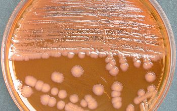 Providencia alcalifaciens Mac Conkey Agar without salt 48h culture incubated with O2