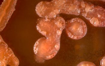 Pseudomonas luteola Mac Conkey Agar without salt 48h culture incubated with O2
