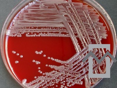 Picture of Ralstonia pickettii