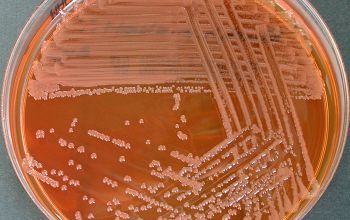 Ralstonia pickettii Mac Conkey Agar without salt 48h culture incubated with O2