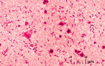 Rhizobium radiobacter Gram stain